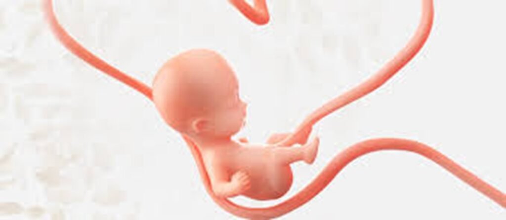 images-12-1024x446 Novas Descobertas sobre o Autismo: A Conexão com o Cordão Umbilical